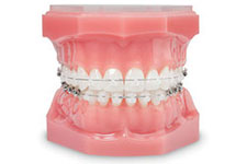 Foto: Ormco Europe B.V.